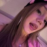 Антотка голая